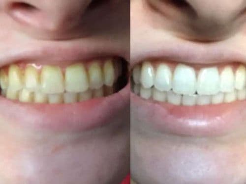 PurePaste - Naturalna siła wybielania!